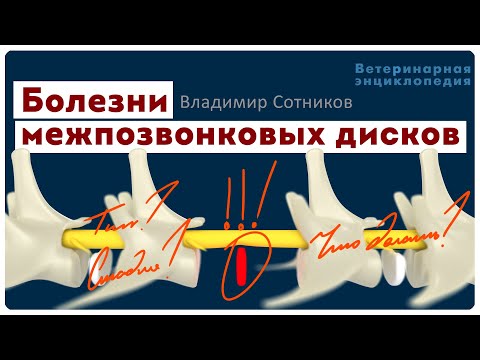 Видео: Болезни межпозвонковых дисков. Классификация, диагностика, лечение