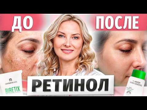 Видео: Как использовать РЕТИНОЛ правильно? МИФЫ И ПРАВДА косметологии