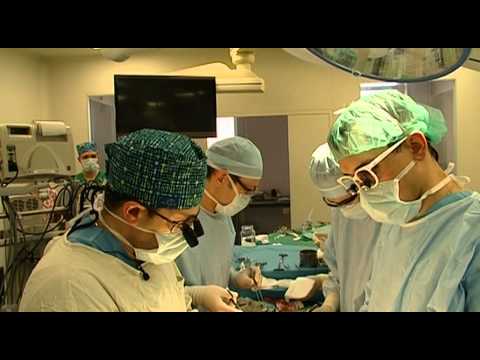 Видео: Аневризма Аорты