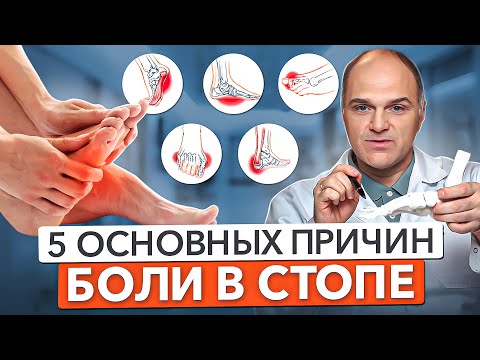 Видео: 5 ОСНОВНЫХ ПРИЧИН БОЛЕЙ В НОГАХ. Почему болят стопы?