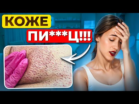 Видео: Результат удаления волос! Как ЭЛЕКТРОЭПИЛЯЦИЯ портит кожу? Не удаляй волосы, пока не посмотришь!