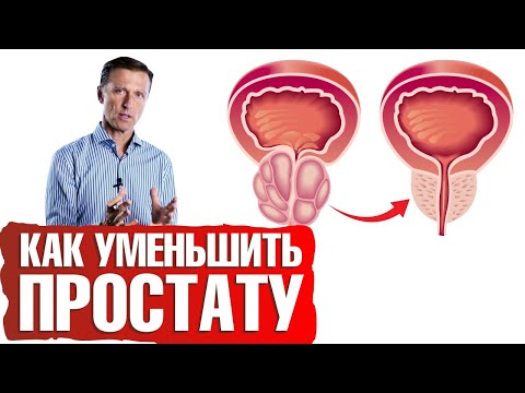 Видео: Аденома простаты, увеличение простаты👉причины и решение проблемы