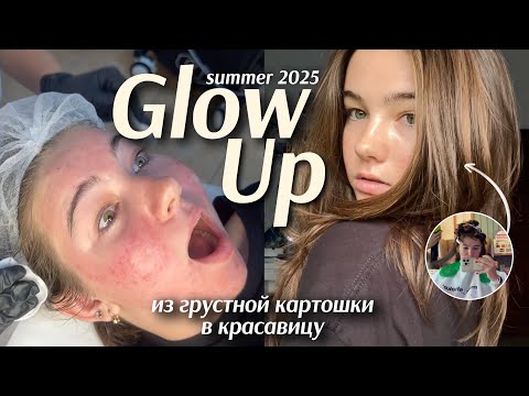 Видео: SUMMER GLOW UP *из задницы в красавицу* || летний ап Грейд🌤️✨