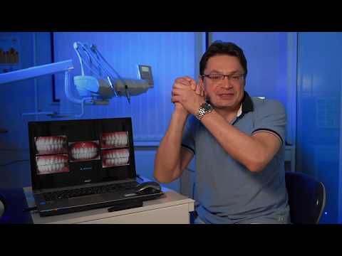 Видео: II часть тотал на циркониевая балка на имплантатах и полный съёмный протез - адаптация