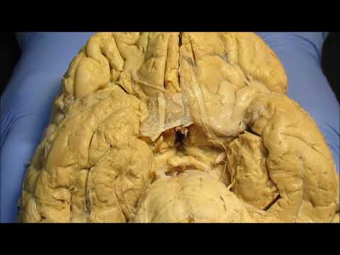 Видео: Основание мозга. Продолговатый мозг. Задний мозг, мост, мозжечок