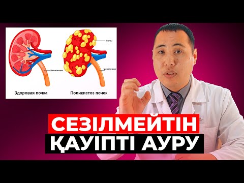 Видео: Бүйректегі киста неден пайда болуы мүмкін? Бұның емі бар ма?