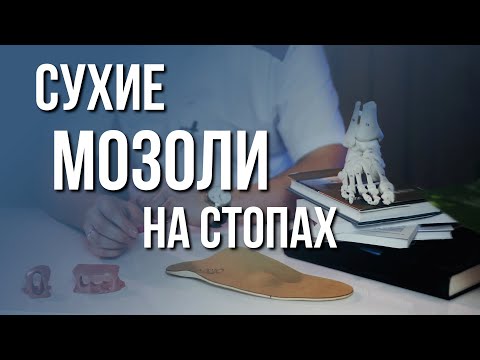 Видео: Сухие мозоли на стопе – как лечить?