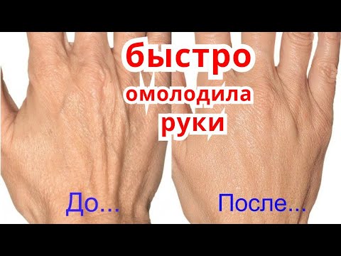 Видео: ОМОЛОЖЕНИЕ Рук Бысто! Сделай Руки Моложе на 10 ЛЕТ! Удаление Морщин с Рук! Уход за Кожей