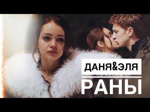 Видео: ► Даня&Эля| раны [Ивановы-Ивановы]