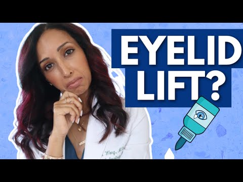 Видео: Капли для подтяжки век? Офтальмолог пробует и оценивает Upneeq