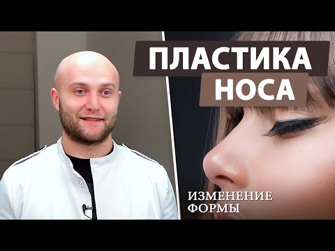 Видео: Ринопластика — что нужно знать! (пластика носа, изменение формы)