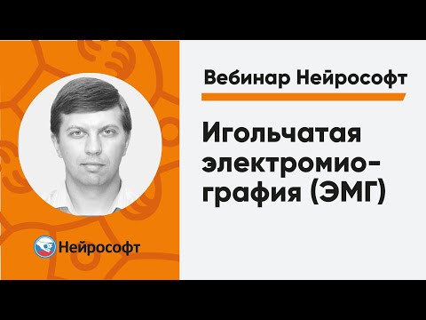Видео: Игольчатая электромиография (ЭМГ) | Вебинар Нейрософт