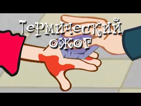 Видео: Термический ожог. Ожоги глаз, полости рта у детей  - Неотложная помощь - Школа Доктора Комаровского