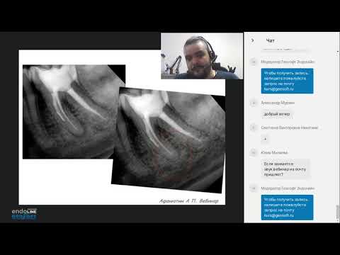 Видео: Endo.Education Вебинар Андрея Афанютина Секреты и особенности работы в зубах со сложной морфологией