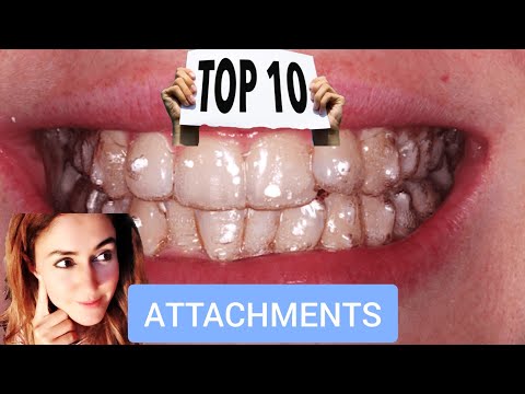 Видео: 10 вещей, которые вам нужно знать о фиксаторах Invisalign