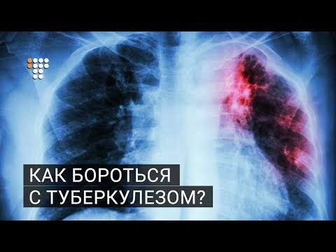 Видео: Как бороться с туберкулезом?