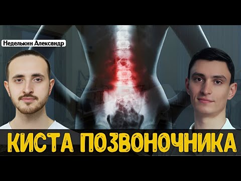 Видео: Что такое киста позвоночника?
