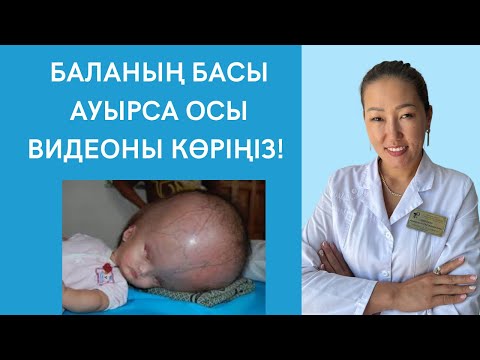 Видео: БҰЛ ВИДЕО БАЛАНЫҢ БАС АУРУЫНАН ҚҰТЫЛДЫРАДЫ! Баланың басы ауырса не істеу керек?