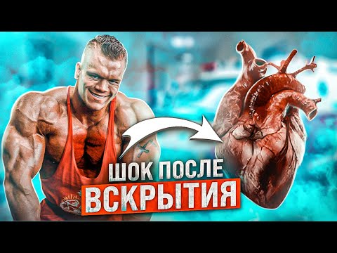 Видео: СЕРДЦЕ РАЗМЕРОМ С ФУТБОЛЬНЫЙ МЯЧ / загадочная смерть Далласа Маккарвера