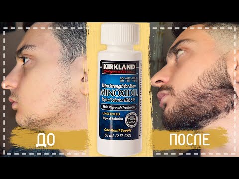 Видео: Как отрастить бороду, если не растет борода? |  Миноксидил отзыв