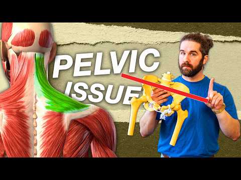 Видео: Упущенная причина бокового наклона таза: слабость плеч — это ВАША основная причина?