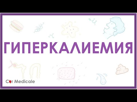 Видео: Гиперкалиемия - причины, механизм развития, последствия, принципы устранения