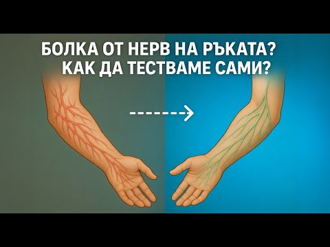 Видео: БОЛКА ОТ НЕРВ НА РЪКАТА? КАК ДА ТЕСТВАМЕ САМИ?