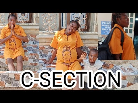 Видео: ПОДГОТОВКА К КЕСАРЕВОМУ СЕЧЕНИЮ // ГОТОВИМСЯ + СЛЕДУЙТЕ ЗА МНОЙ В БОЛЬНИЦУ