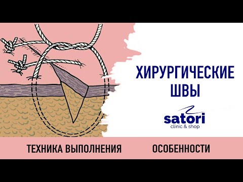 Видео: Хирургические швы в стоматологии
