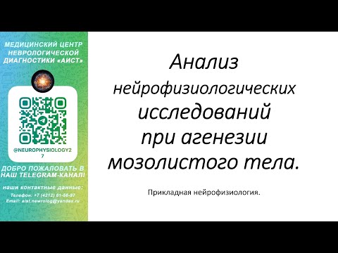 Видео: Тема: Анализ нейрофизиологических исследований при агенезии мозолистого тела.