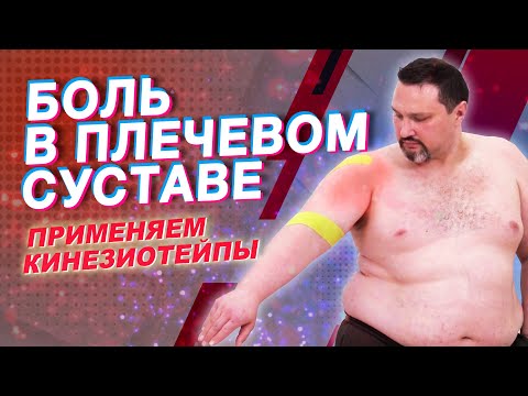 Видео: ▶️ БОЛЬ В ПЛЕЧЕВОМ СУСТАВЕ. ПРИМЕНЯЕМ КИНЕЗИОТЕЙПЫ | Валентин Гайт | Учебный центр BBALANCE