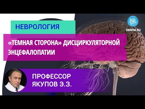 Видео: Профессор Якупов Э.З.: «Темная сторона» дисциркуляторной энцефалопатии