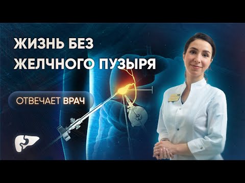 Видео: Как жить без желчного пузыря? Что будет после холецистэктомии?