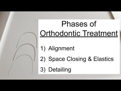 Видео: Фазы передачи и последовательность проводов