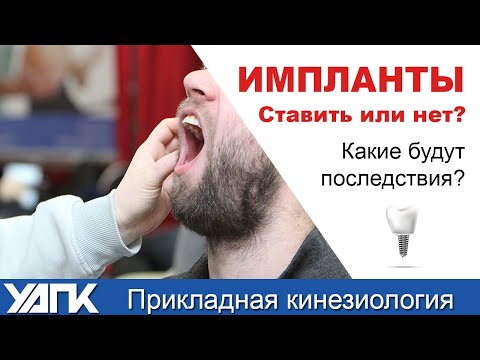 Видео: Как влияют ИМПЛАНТЫ на тело? (Евгения Чижикова)