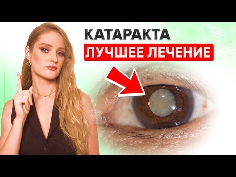 Видео: КАК ОСТАНОВИТЬ КАТАРАКТУ И Глаукому? Упражнения и Витамины для глаз