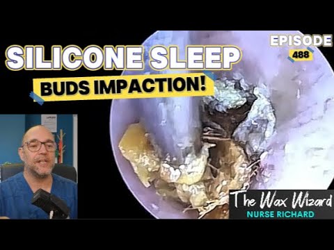 Видео: Силиконовые беруши для сна: защемление! Эпизод 488 (и пациент, которому по ошибке продали слухово...