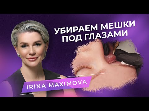 Видео: Камуфляж темных кругов под глазами. Мастер PMU Ирина Максимова