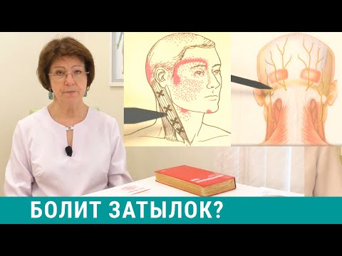 Видео: Болит затылок? Головная боль в затылке: причины и лечение