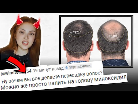 Видео: ☝ Миноксидил НЕ работает | Способы увеличения эффективности ↓ Андрогенная алопеция...