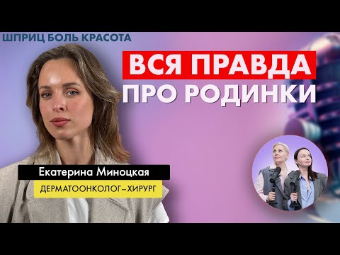Видео: Вся правда про родинки и меланому: как не пропустить рак кожи