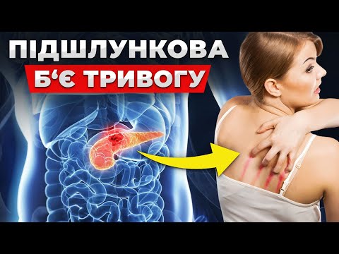 Видео: ЦЕ перші ознаки ПРОБЛЕМ з підшлунковою! Симптоми та ПРАВИЛЬНЕ лікування!