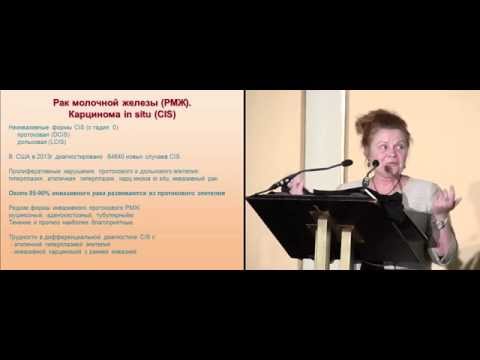 Видео: Взгляд химиотерапевта