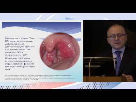 Видео: 5 Паратонзиллярный абсцесс. Основные возбудители и принципы антибактериальной терапии.