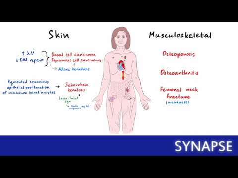 Видео: Патологии, характерные для людей пожилого возраста| Synapse sketches