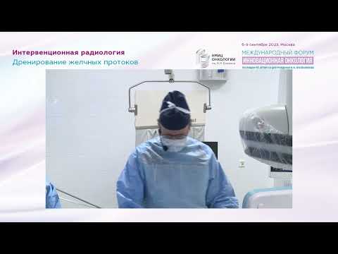 Видео: Дренирование желчных протоков. Антеградная холангиоскопия + биопсия. Фотодинамическая терапия.