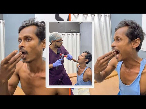 Видео: Избавление от боли в височно-нижнечелюстном суставе и расширение диапазона открывания рта