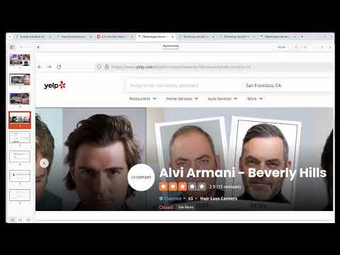 Видео: Пересадка волос в Аргентине. Как заманивают и уродуют. Красавчик и Alvi Armani.