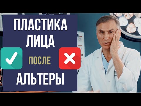 Видео: КРУГОВАЯ ПОДТЯЖКА ЛИЦА ❌ ПОСЛЕ СМАС ЛИФТИНГ АЛЬТЕРА 🔥 РЕАЛЬНО⁉️