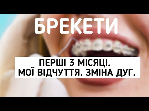 Видео: БРЕКЕТИ |  3 МІСЯЦІ | ЗМІНА ДУГ | МОЇ ВІДЧУТТЯ | КОЛЬОРОВІ РЕЗИНКИ